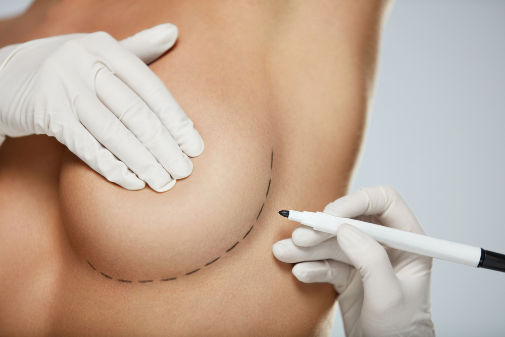 LIVE MAKEOVER 4 AESTHETIC SURGERY SYMPOSIUM