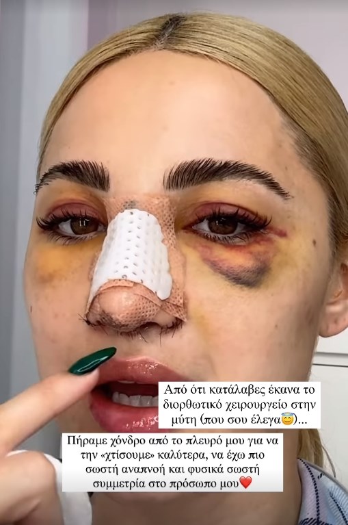 Ιωάννα Τούνη