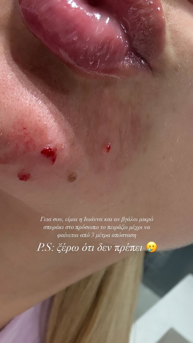 Η Ιωάννα Τούνη στην πιο απροσχημάτιστη εκδοχή της - Η κακή συνήθεια στην οποία δεν αντιστέκεται