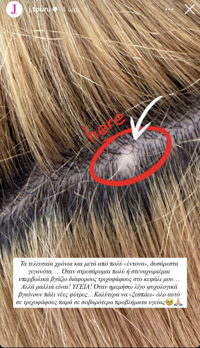 Η Ιωάννα Τούνη αποκαλύπτει για το ζήτημα υγείας της: "Όταν στεναχωριέμαι υπερβολικά..."