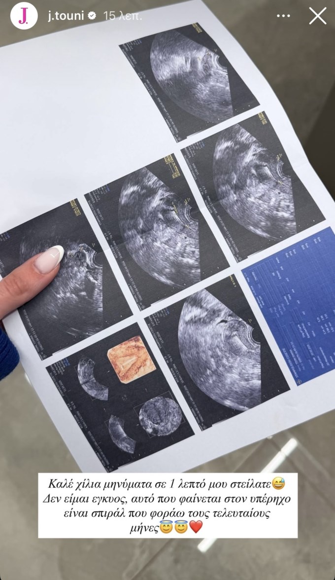 Ιωάννα Τούνη story