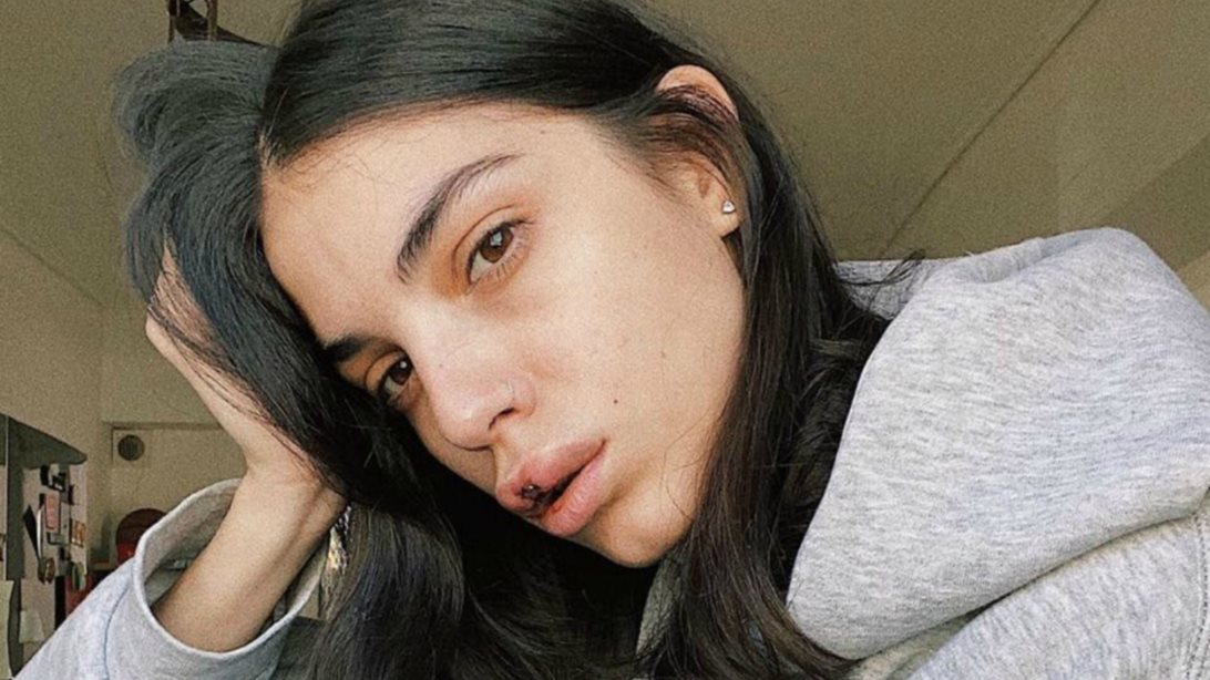 Άννα Μαρία Βέλλη : Το ατύχημα και η φοβερή παραμόρφωση στα χείλη
