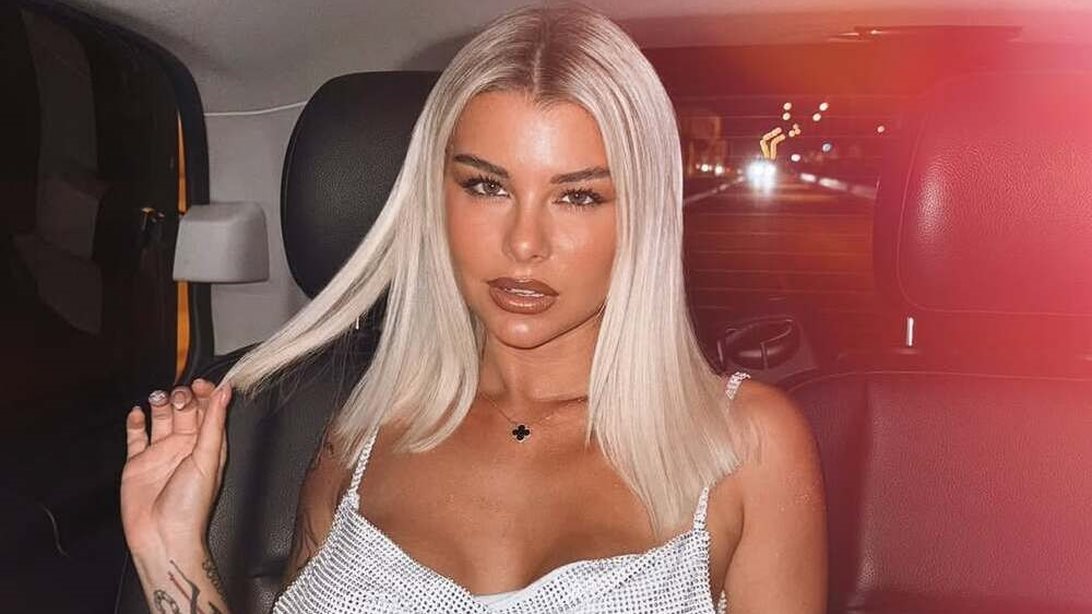 H Modern Cinderella δείχνει on camera το δερματικό, ψυχοσωματικό της πρόβλημα