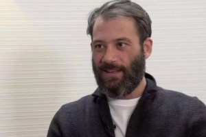 Αντίνοος Αλμπάνης: Πριν από το πρόβλημα της υγείας μου είχα το "βλέμμα της αγελάδας" - εικόνα 2