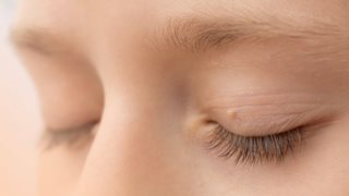 Θηλώματα: Ενοχλητικές αλλά όχι μεταδοτικές δερματικές βλάβες που λαθεμένα αποδίδονται στον ιό HPV