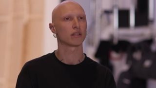 MasterChef | Διαγωνιζόμενος σοκάρει: "Ξύπνησα και τα μισά μου μαλλιά ήταν στο κρεβάτι"