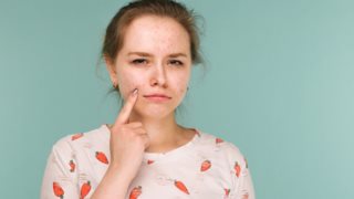 Επηρεάζει το στρες την ακμή στους εφήβους;