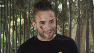 Ο iLLEOo μίλησε πρώτη φορά για το τροχαίο που είχε:  &quot;Δεν φορούσα κράνος, νόμιζαν ότι είμαι νεκρός&quot;