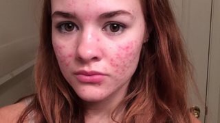 Φωτογράφιζε την ακμή της και έγινε viral!
: Αυτό το κορίτσι θα σου δώσει τη δύναμη που χρειάζεσαι!