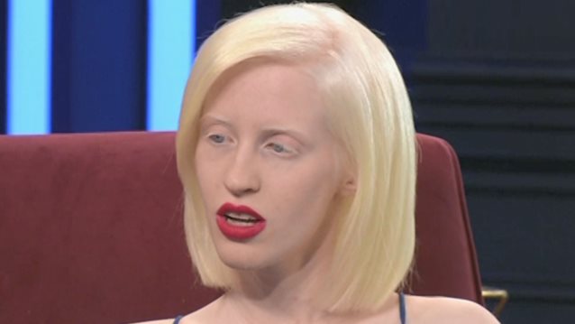 Ανδριανή Ζαχάρη : Το μοντέλο με Αλφισμό στα «Μεσάνυχτα» | Ο ρατσισμός &amp;  το μόντελινγκ