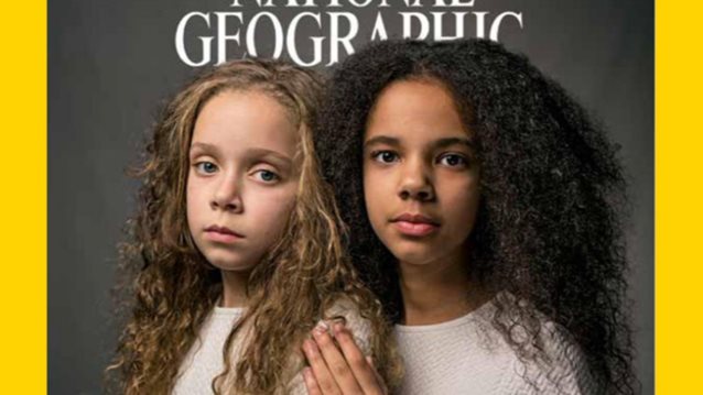 National Geographic: Δύο δίδυμες γράφουν ιστορία στο εξώφυλλο του
