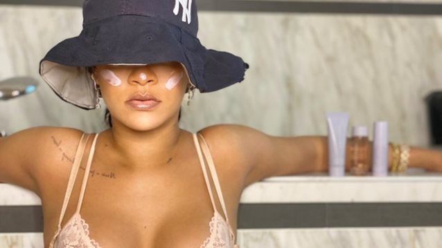 Rihanna: Δεν αποχωρίζεται ποτέ το αντηλιακό της και έχει έναν πολύ καλό λόγο γι&#39; αυτό
