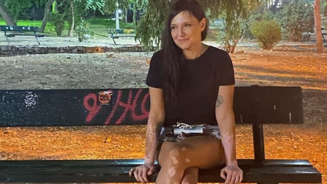 Αθηναΐς Νέγκα για το χυδαίο σχόλιο που δέχθηκε: &quot;Εγώ ανέβασα μια καλοκαιρινή φωτογραφία, τίποτα άλλο&quot;