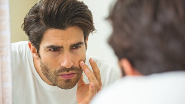 Μάθε τα μυστικά!
: Πώς θα ξεφορτωθείς τους μαύρους κύκλους κάτω από τα μάτια
