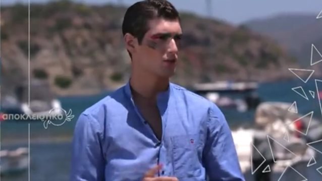 GNTM: Αυτό είναι το πλεονέκτημα του Αιμιλιάνο στη σημερινή φωτογράφιση