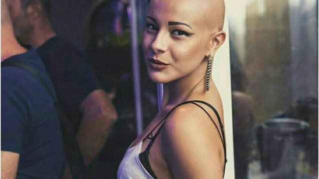 GNTM | Λυδία Κατσανικάκη: Η συγκινητική ιστορία της παίκτριας με την αλωπεκία