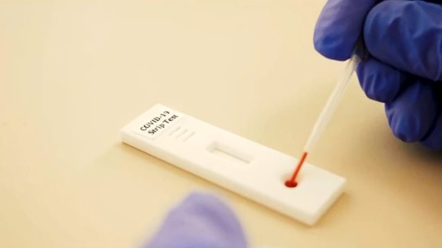 Self test κορονοϊού: Πώς θα τα κάνουμε στο σπίτι