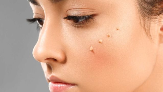 No-Makeup Makeup: Το τρικ που κάνει την πραγματική διαφορά