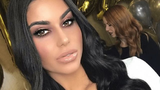 Ιωάννα Μπέλλα : Aποφάσισε να αφαιρέσει το υαλουρονικό από τα χείλη της (Δείτε πλάνα)
