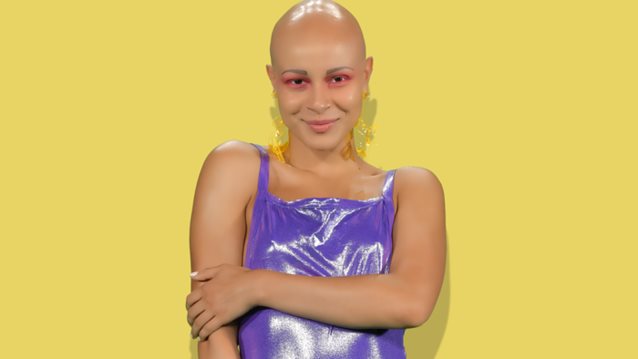 Λυδία Κατσανικάκη: Αποκάλυψε τις δυσκολίες που αντιμετώπισε λόγω της αλωπεκίας