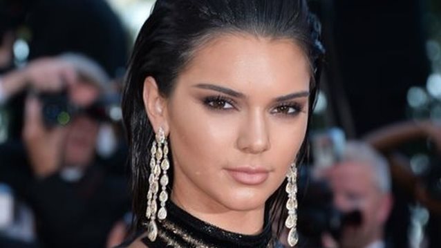 Κendall Jenner : H αλήθεια για τη φημολογούμενη αισθητική επέμβαση που έκανε
