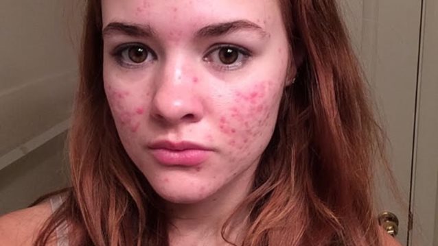 Φωτογράφιζε την ακμή της και έγινε viral!
: Αυτό το κορίτσι θα σου δώσει τη δύναμη που χρειάζεσαι!