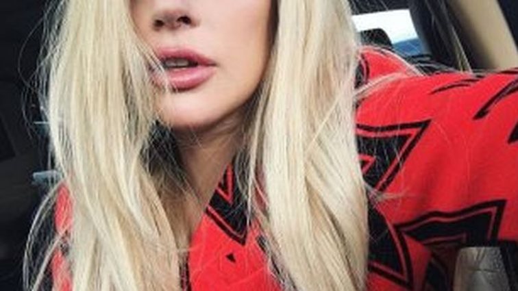 Lady Gaga: Η εμφάνιση που πυροδότησε τα σχόλια για αισθητική επέμβαση στα χείλη της