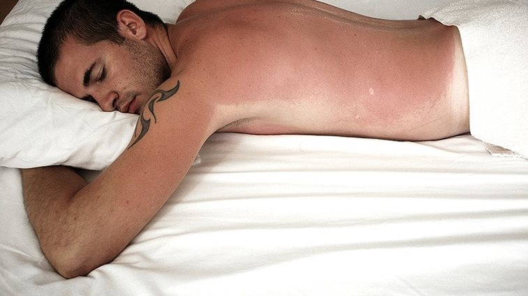 Πώς θα περιποιηθείς τα εγκαύματα του ήλιου για να μην υποφέρεις
: Πρώτες βοήθειες για καμένους.
