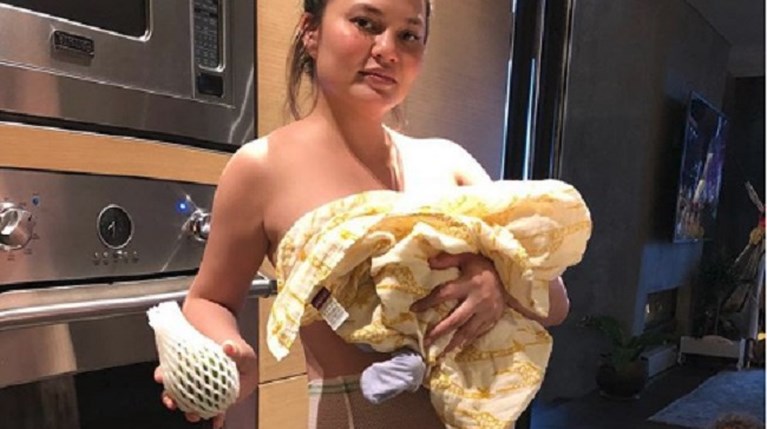 Chrissy Teigen